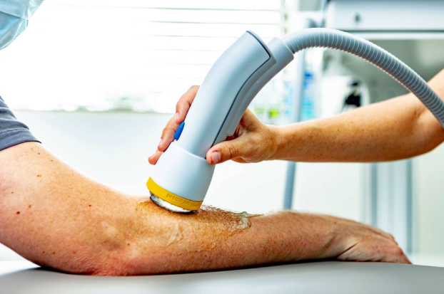 What Actually Happens Inside Your Body During SoftWave Therapy (And Why Most Providers Don't Explain It)